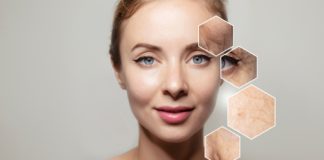 Woman with highlighted skin imperfections on her face.