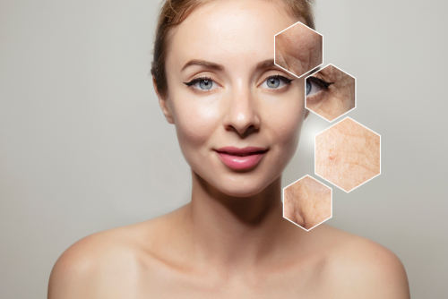 shutterstock_1435664921.jpg featured image Woman with highlighted skin imperfections on her face.