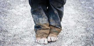 HORRIFYING Starvation Case — Toddler Ate Diapers A child standing barefoot on a gravel surface with dirty pants