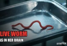 Travelers Urged To Take Warning After Spike In Parasites! She ate Wild Greens. One Year Later, They Pulled A Live Worm From Her Brain.