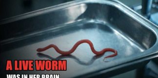 Travelers Urged To Take Warning After Spike In Parasites! She ate Wild Greens. One Year Later, They Pulled A Live Worm From Her Brain.