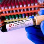 Gloved hand holding an STI test tube labeled positive