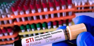 Controversial AIDS-Era Ban Brought Back! Gloved hand holding an STI test tube labeled positive